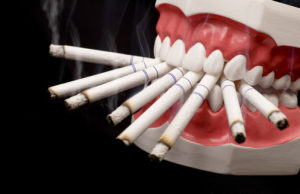 Как курение влияет на зубы